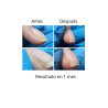 OniStop NAILS OF THE DAY, aceite regenerador para uñas con onicolisis, 15ml