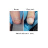 OniStop NAILS OF THE DAY, aceite regenerador para uñas con onicolisis, 8ml